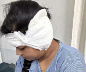 Ear surgery in bhubaneswar