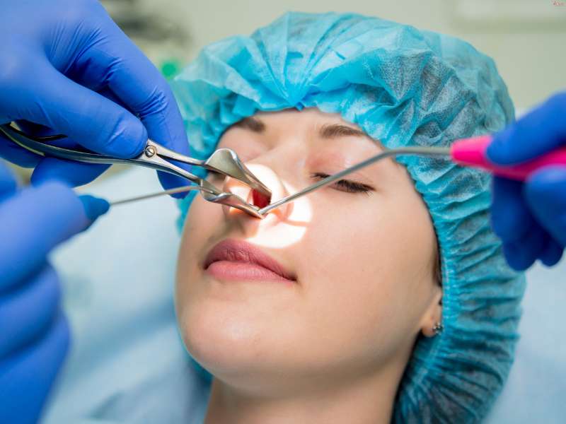 Functional Endoscopic sinus surgery bhubaneswar