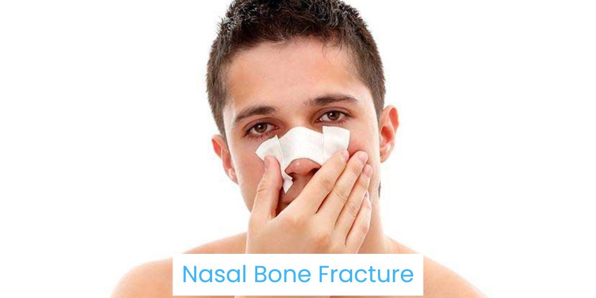 Nasal Bone Fracture Treatment in Bhubaneswar