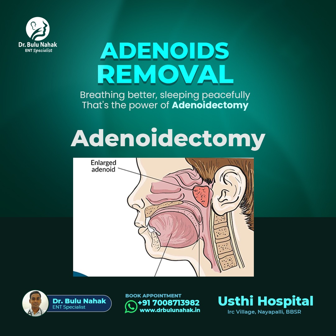 Adenoidectomy in Bhubaneswar: Safe Adenoids Removal for Better Breathing & Sleep