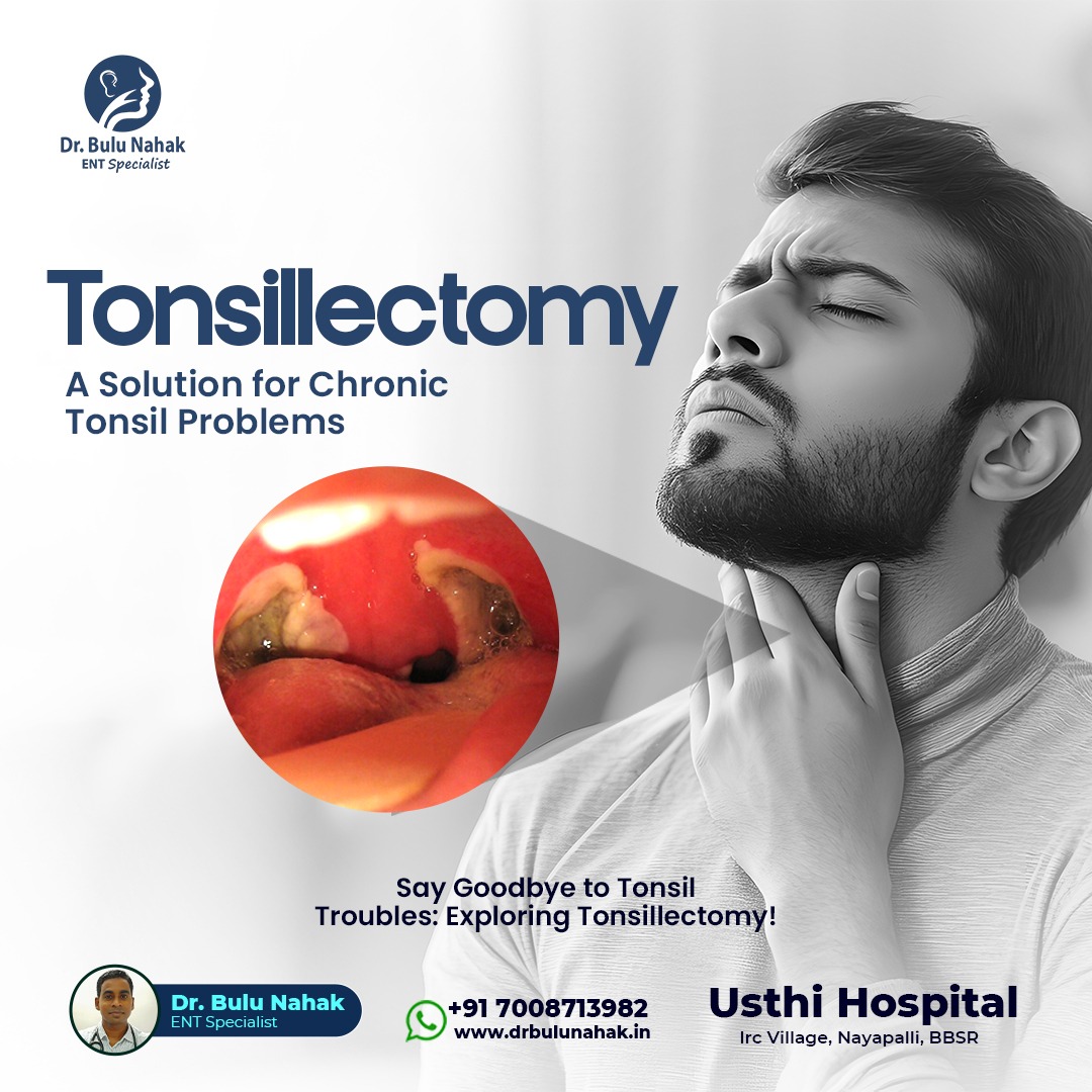 Tonsillectomy: A Proven Solution for Chronic Tonsil Problems