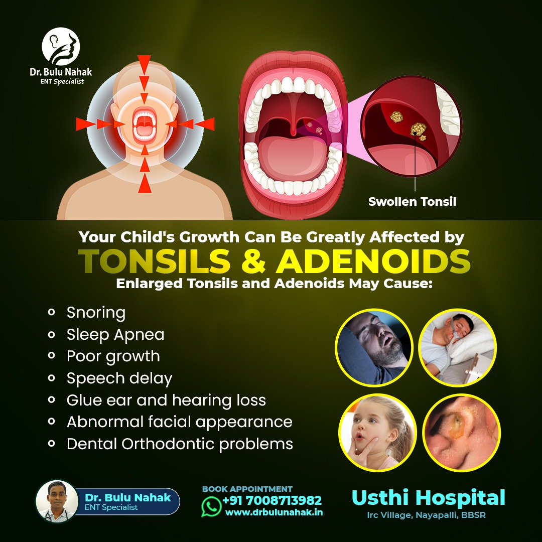 How Tonsils & Adenoids Affect Your Child’s Growth: Signs Parents Should Not Ignore