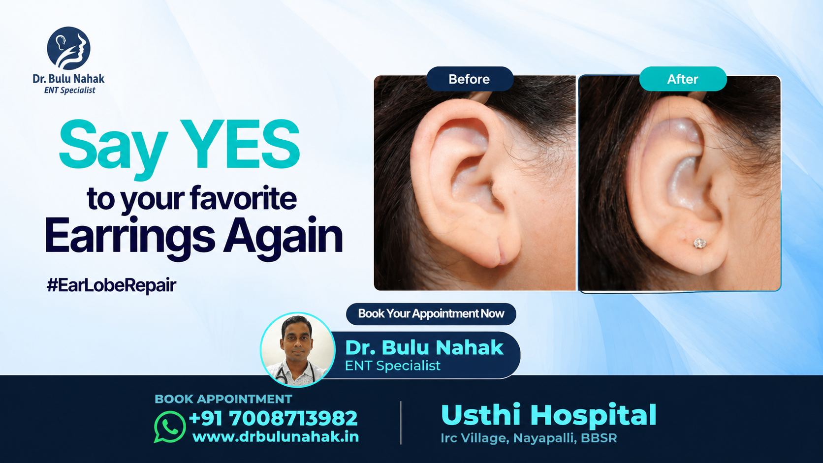 Ear Lobe Repair Surgery: Say Yes to Your Favorite Earrings Again