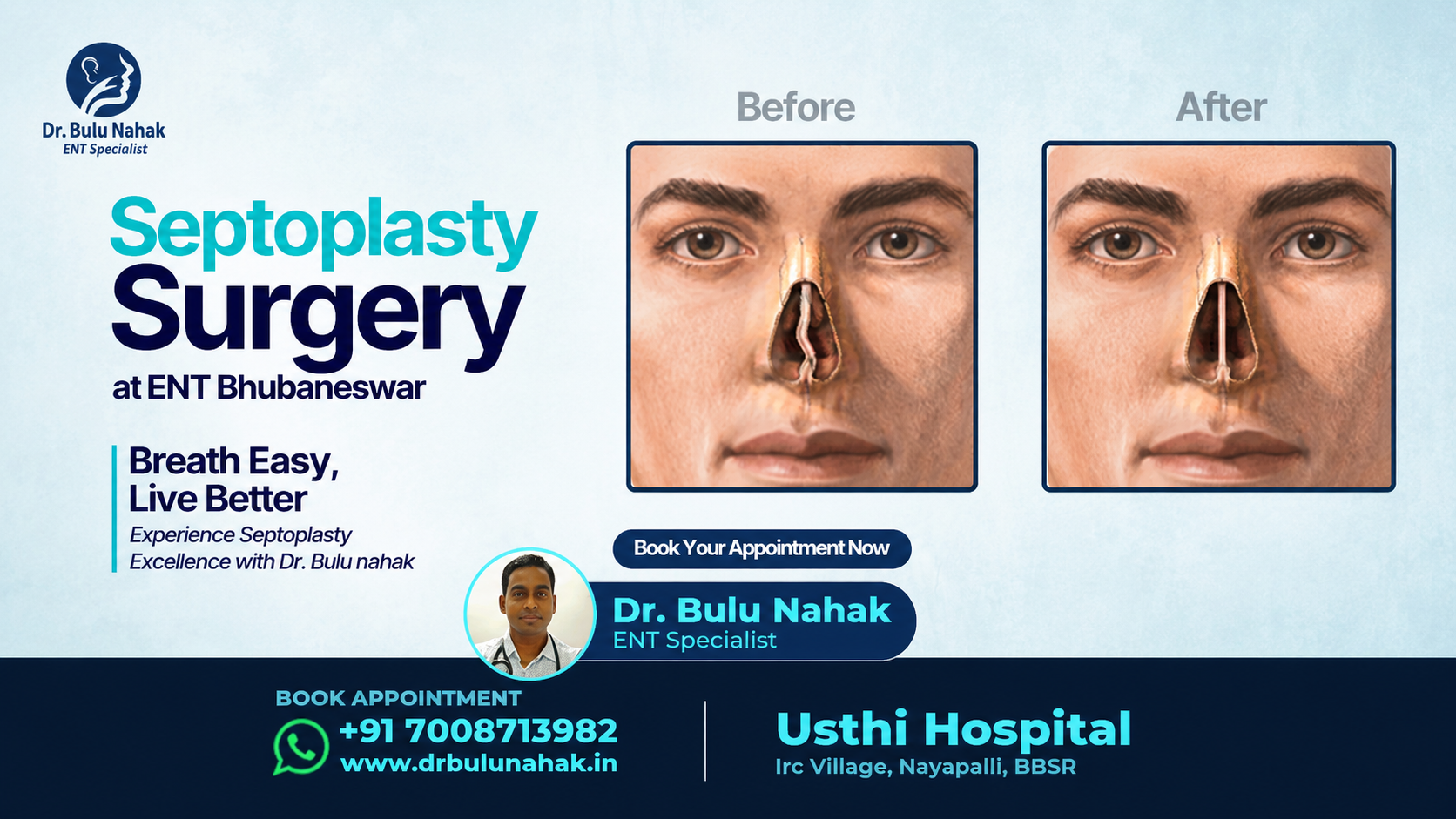 Septoplasty Surgery in Bhubaneswar: Breathe Easy, Live Better with Expert ENT Care