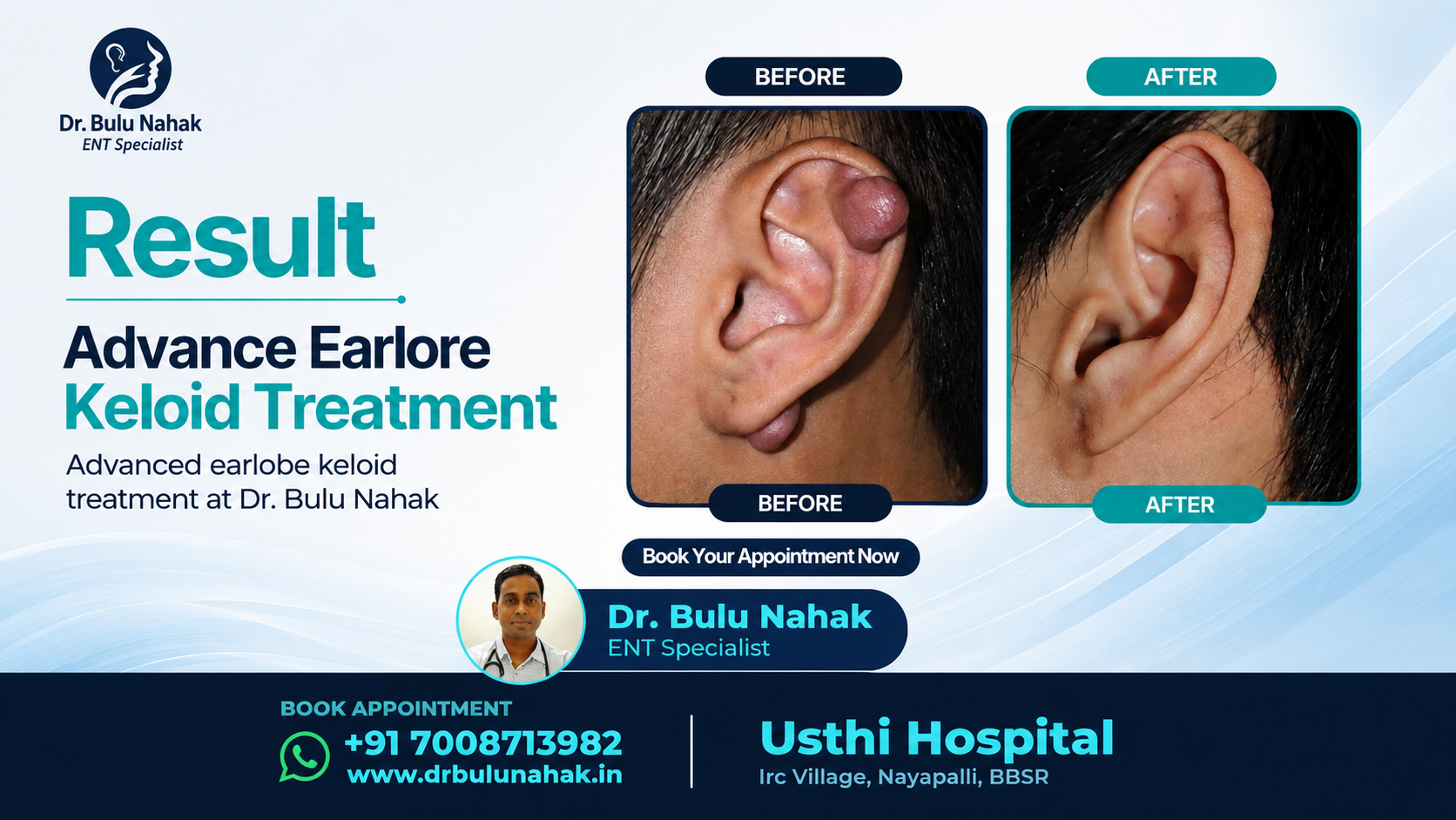 Advanced Earlobe Keloid Treatment in Bhubaneswar: Safe, Effective Solutions for Healthy Ears